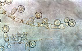 candida